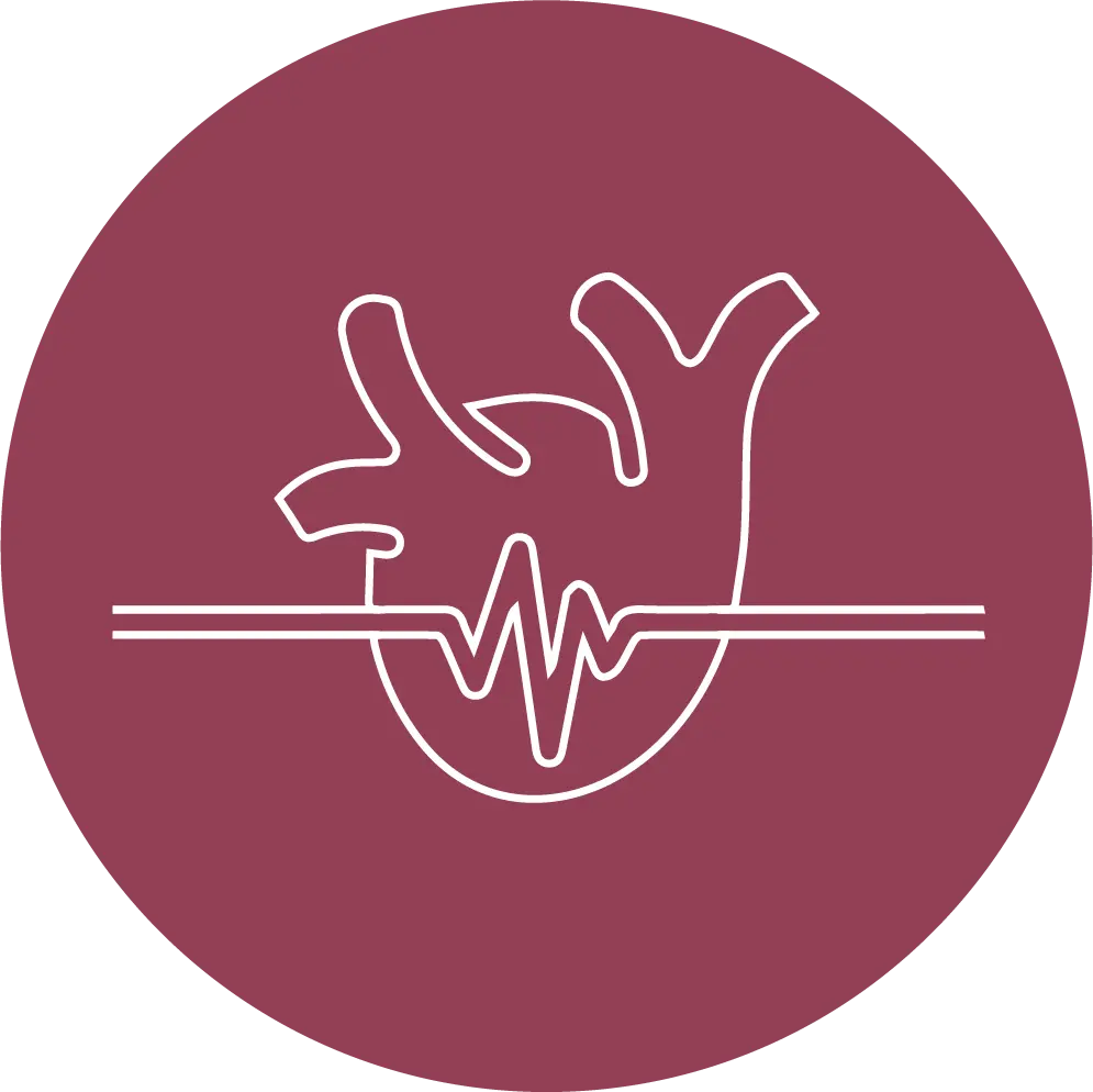 Image of Arrhythmias 