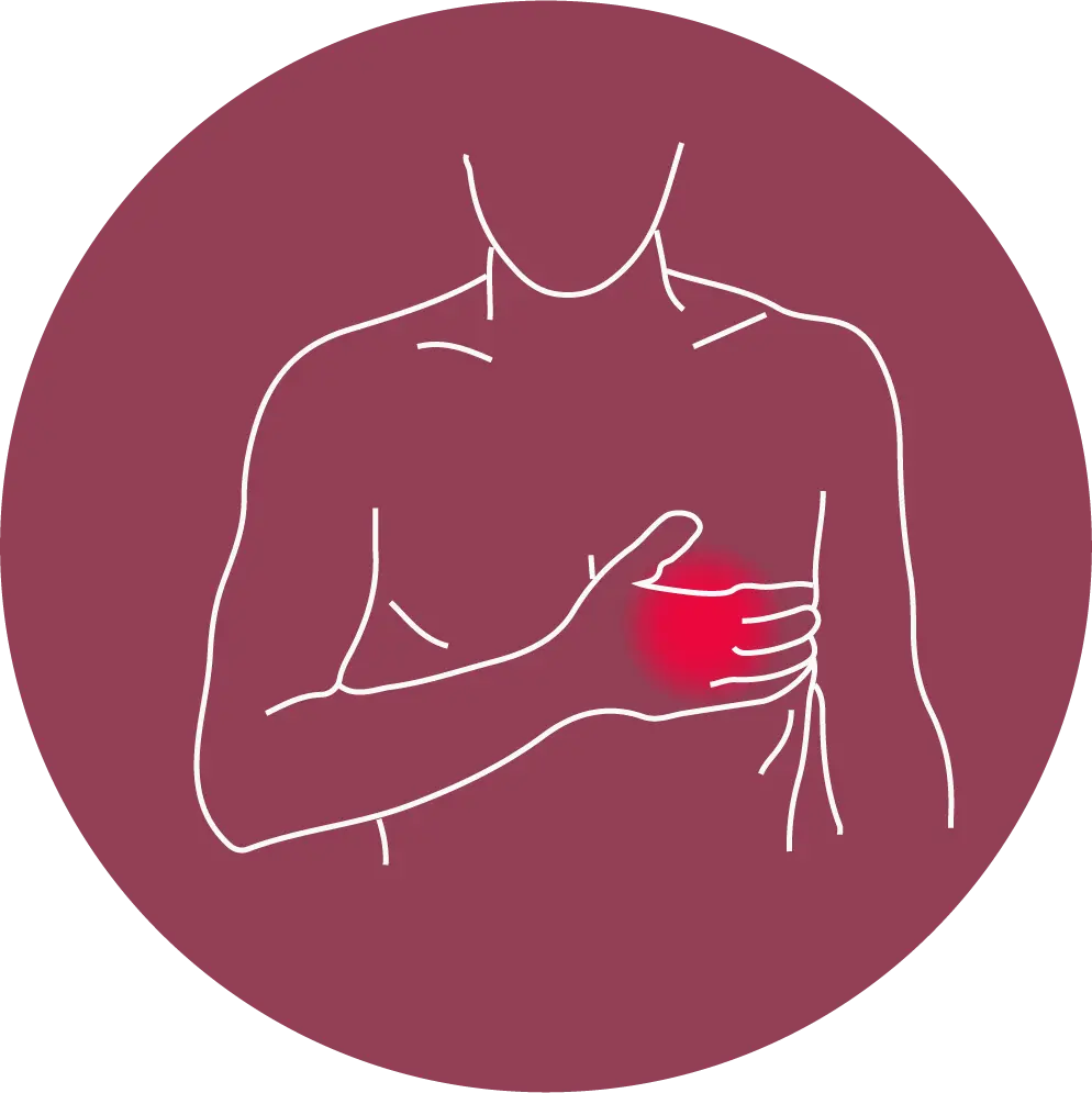 Image of Palpitations 