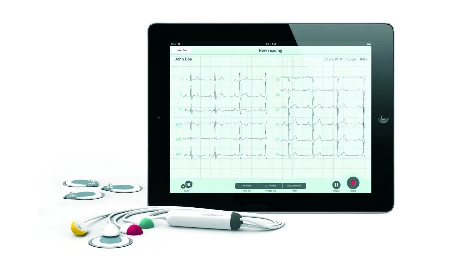 ELECTROCARDIOGRAM