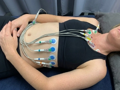 EKG Lead Placement in Females