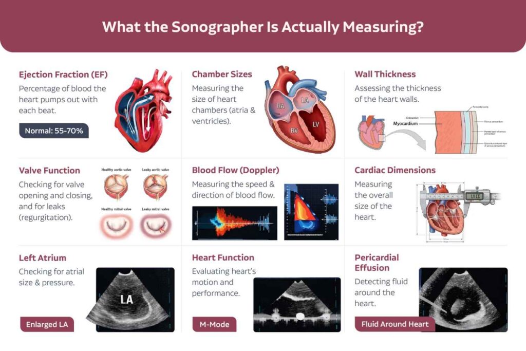 What a sonograoher measure in echocardiogram