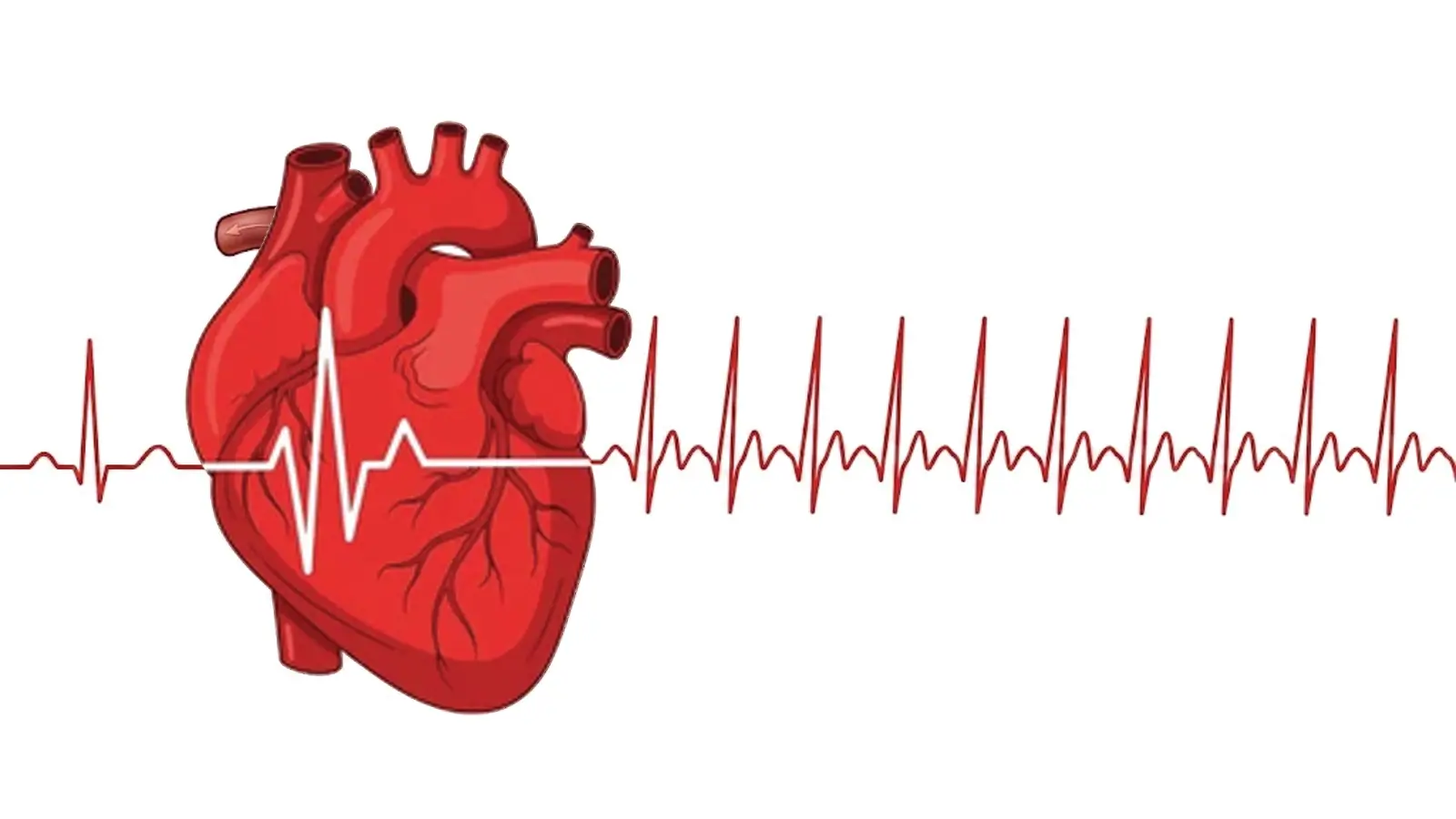 Postural Orthostatic Tachycardia Syndrome (POTS)