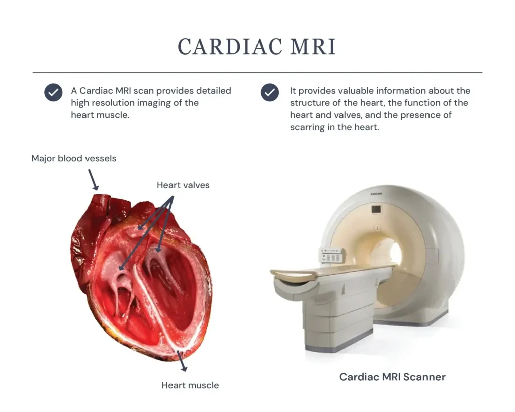 What Does a Cardiac MRI Show? Can it Detect Blockages? 2 What can a heart MRI detect