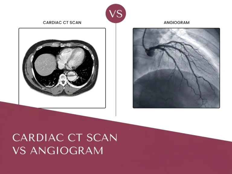 Cardiac CT Scan Vs CT Angiogram