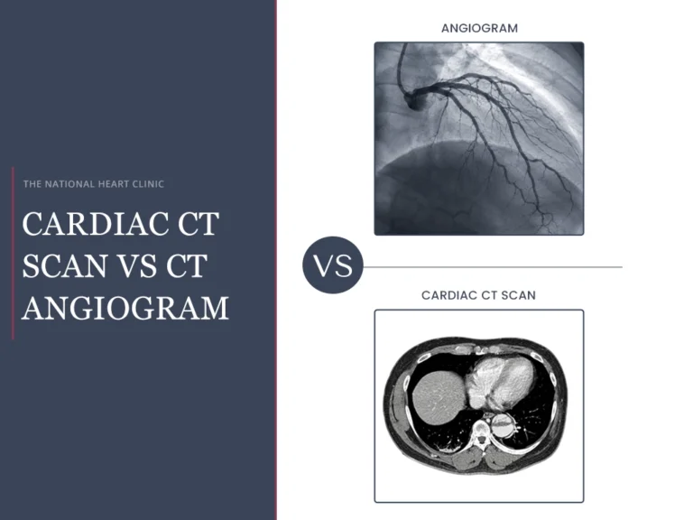 Cardiac CT Scan Vs CT Angiogram: What is the Difference?