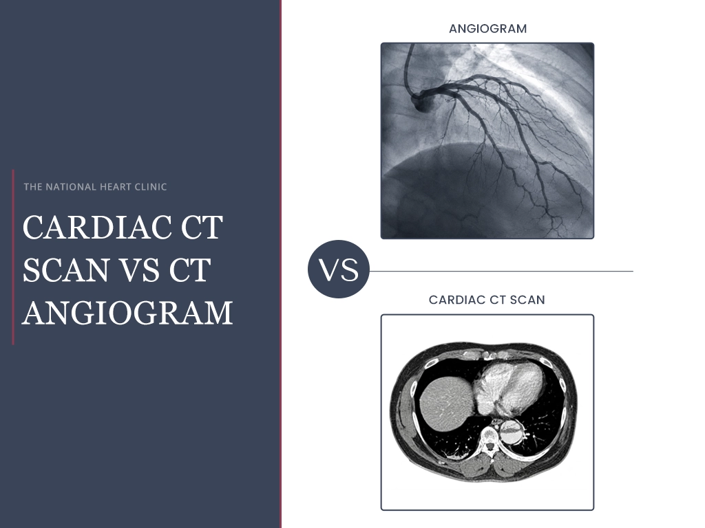 Cardiac CT Scan Vs CT Angiogram