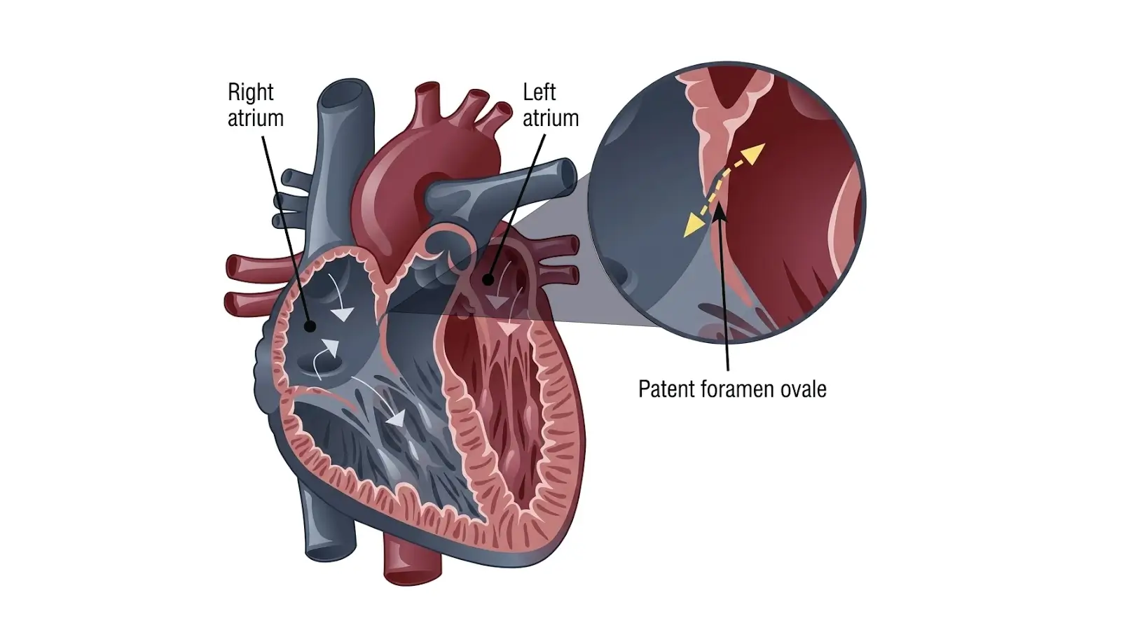 Private-Bubble-Echocardiogram