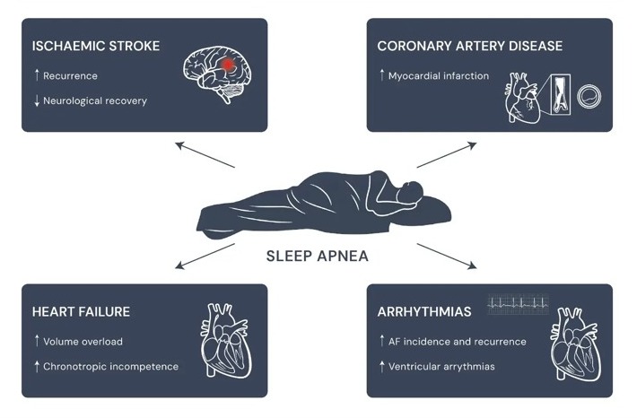 How Sleep Apnoea Affect the Heart? Complete Guide 3 Cardiovascular Risks Associated with Sleep Apnoea-The National Heart Clinic, UK