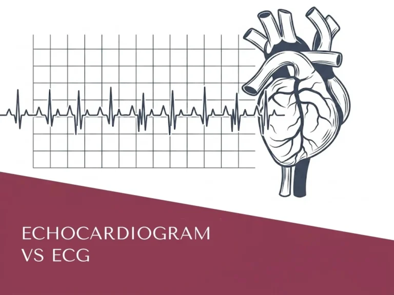 ECG Vs Echocardiogram