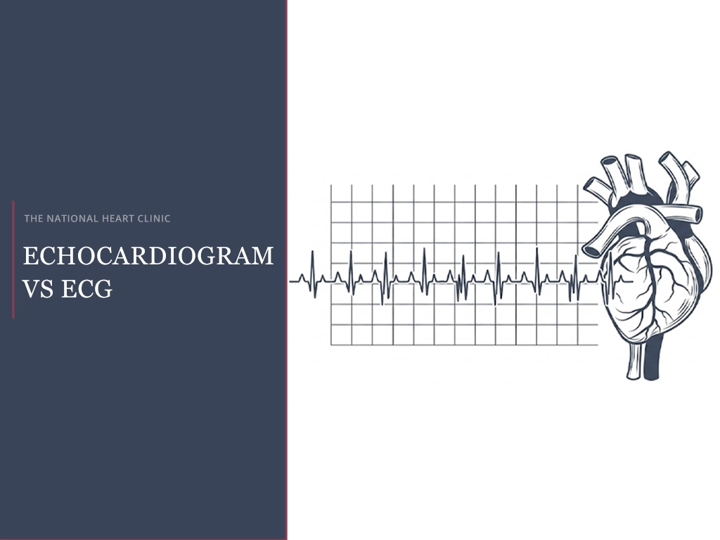 ECG Vs Echocardiogram