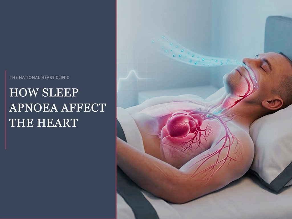 How Sleep Apnoea Affect the Heart