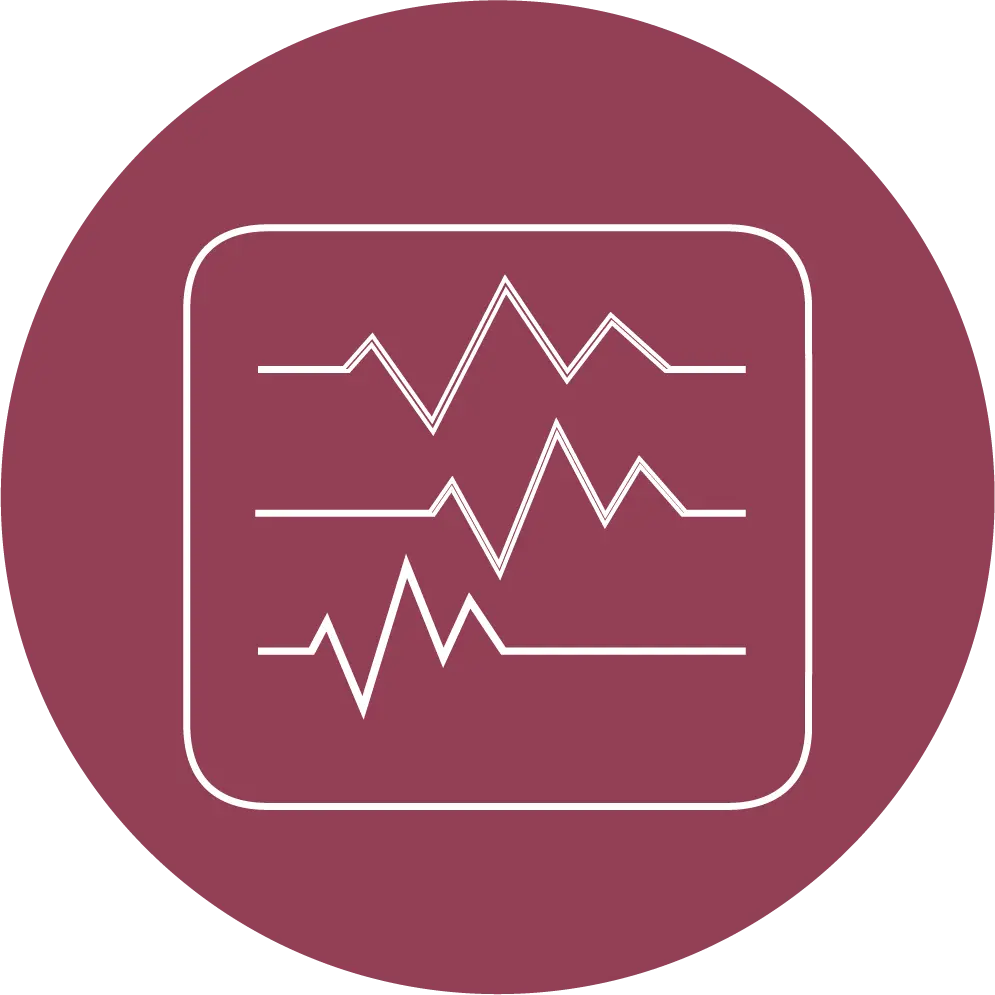 Electrocardiogram 