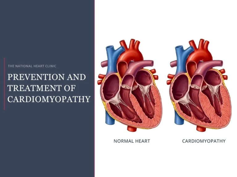 prevention and treatment of cardiomyopathy
